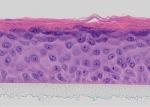 Ein histologischen Schnitt der menschlichen Haut mit den verschiedenen Schichtender Epidermis, darunter das verhornende Plattenepithel